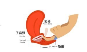 menstrual disc instruction 月亮蝶片用法